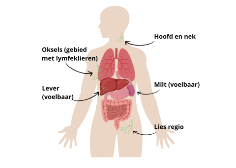 Vervangende afbeelding