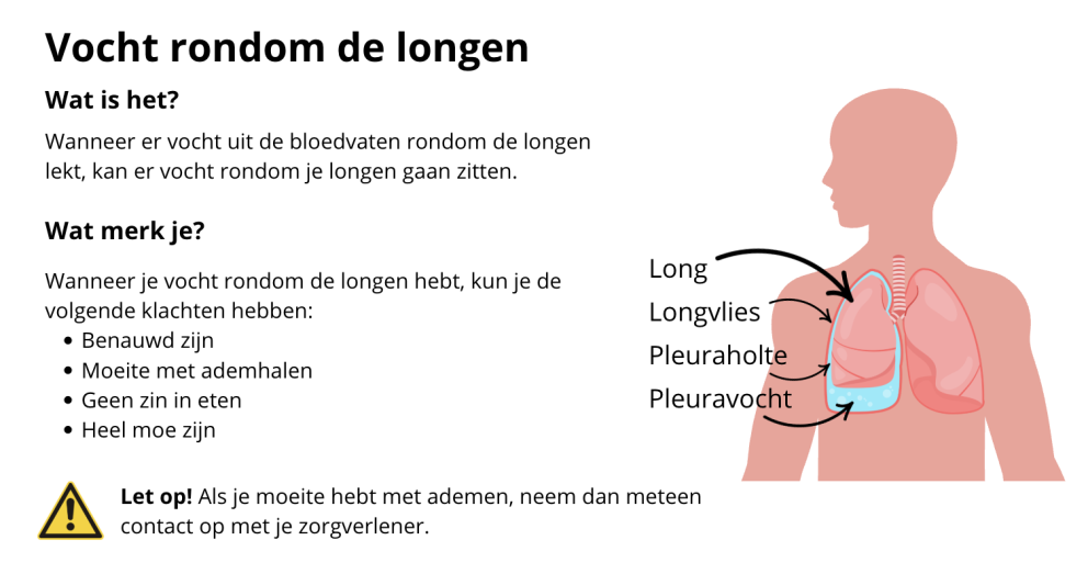 Vervangende afbeelding